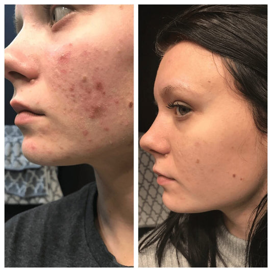 CeraVe Hydrating Facial Cleanser