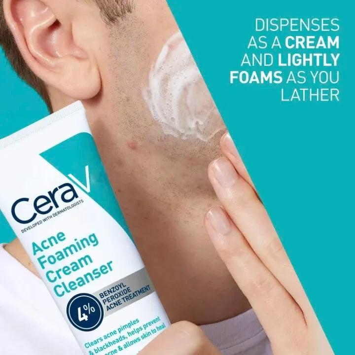 Acne Foaming Cream Face Wash | Anti Acne Cleanser | Deep Cleansing Face Wash for Pimples & Breakouts | Acne Control | Oil Contro l & Skin Soothing Daily Cleanser | Best for Acne Prone Skin Men & Women